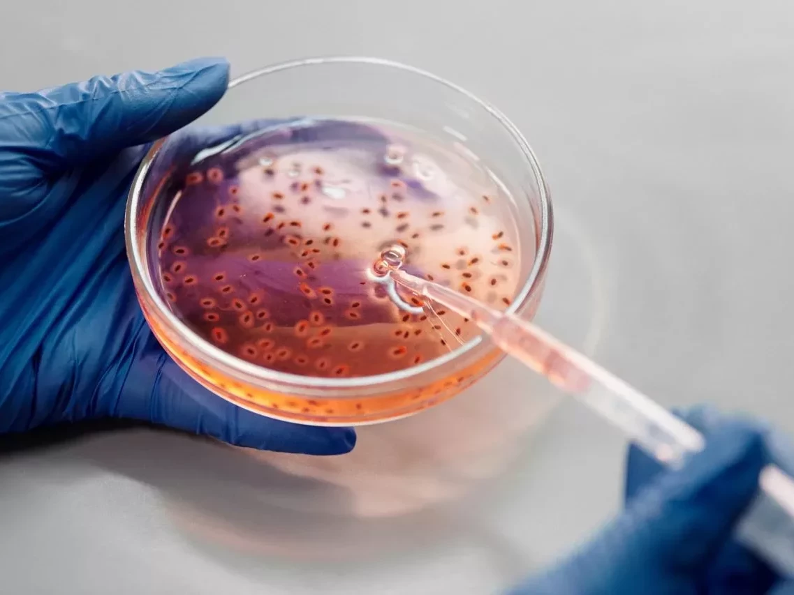 Eine Petrischale mit Nährboden und einer Pipette daran, gehalten von zwei Händen in Handschuhen