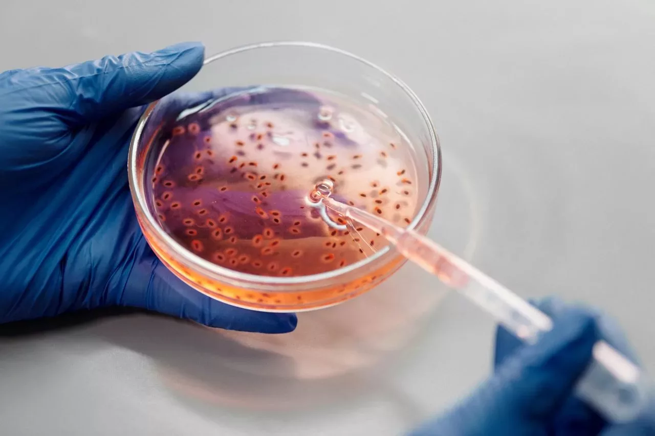 Eine Petrischale mit Nährboden und einer Pipette daran, gehalten von zwei Händen in Handschuhen